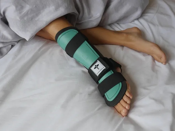 Splint Image