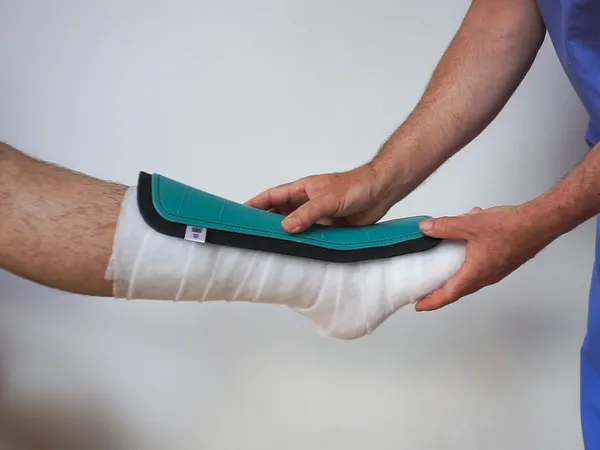 Trauma Splint Image
