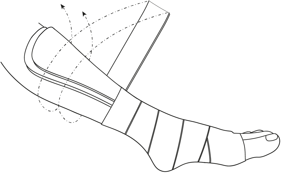 Trauma Splint Image